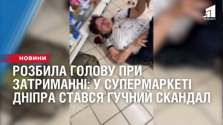 rozbyla-golovu-pry-zatrymanni-u-supermarketi-dnipra-stavsya-guchnyj-skandal