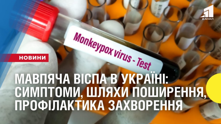 mavpyacha-vispa-v-ukrayini-symptomy-shlyahy-poshyrennya-profilaktyka-zahvorennya