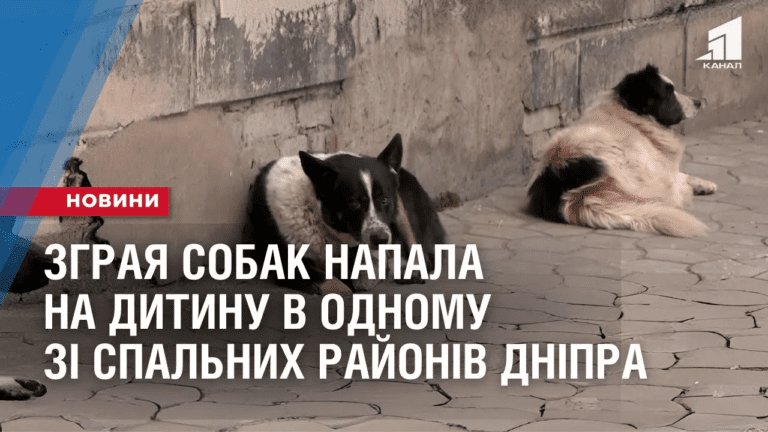 zgraya-sobak-napala-na-dytynu-v-odnomu-zi-spalnyh-rajoniv-dnipra