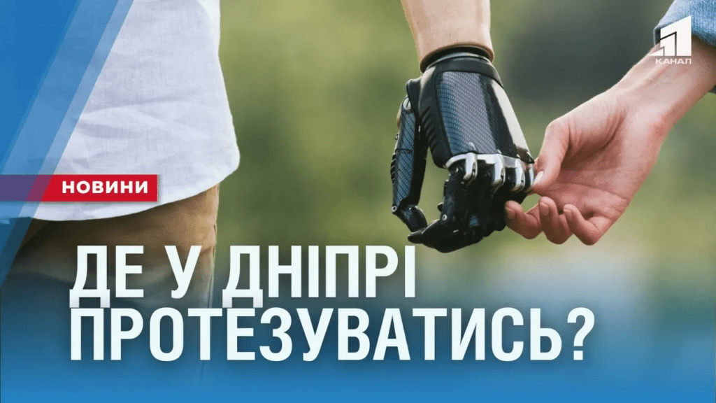 protezy-mylyczi-ta-krisla-u-dnipri-cze-roblyat-na-p-yaty-pidpryyemstvah-kudy-zvertatysya