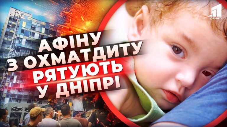 z-roztroshhenogo-ohmatdytu-v-dnipro-istoriya-malenkoyi-divchynky-yaku-vryatuvalo-dyvo